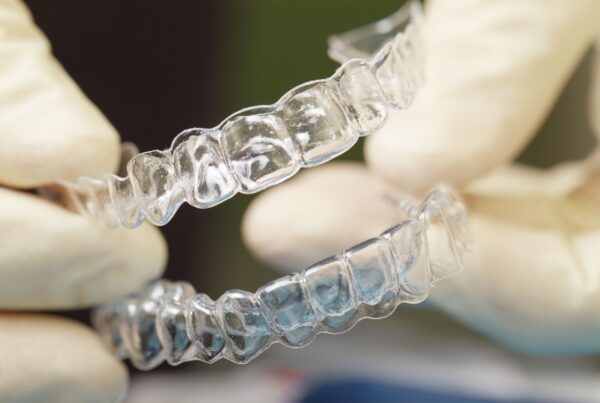Clear Essix retainers held in hands wearing sterile gloves at Saxe Orthodontics