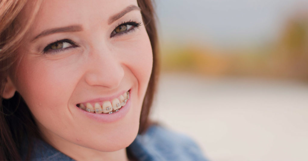 adult wearing braces uses mouthwash