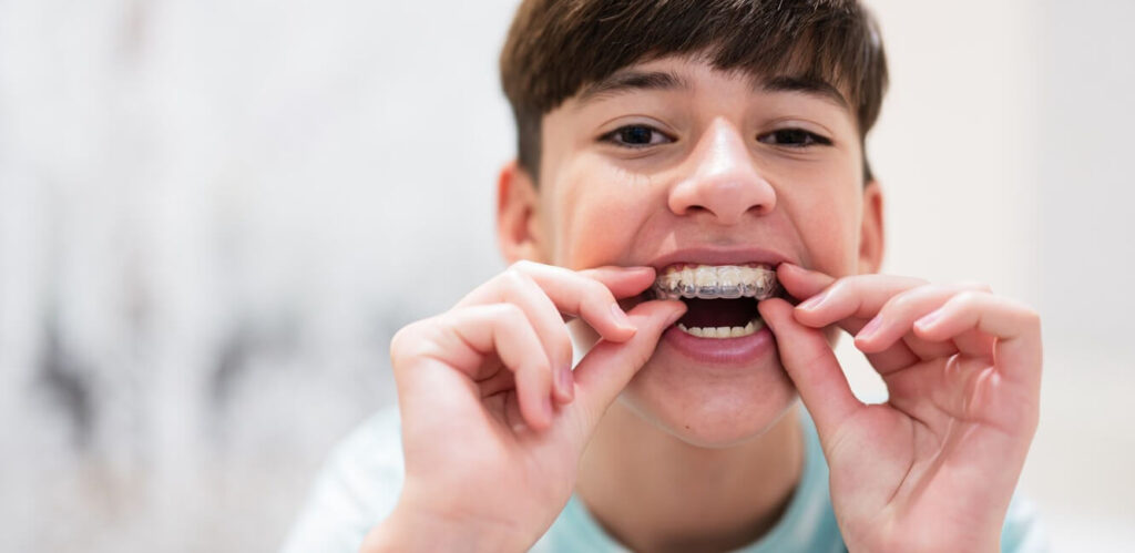 teen wonders How long will I have to wear braces